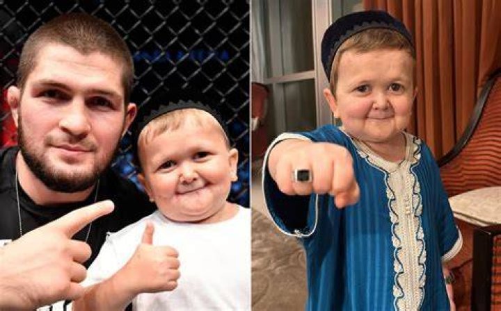 The Theory About Hasbulla Magomedov's Rare Condition